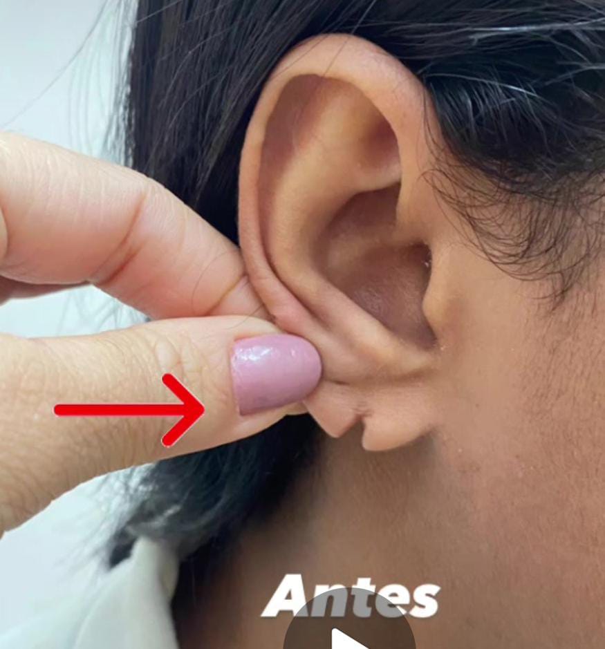 Antes do procedimento 2