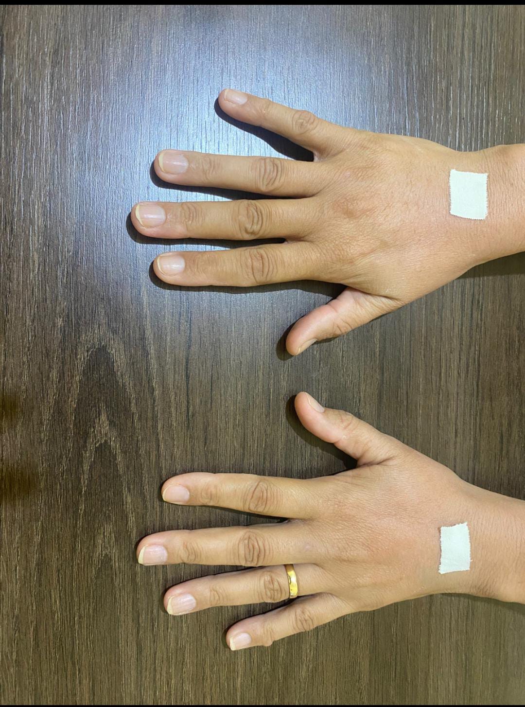 Harmonização das Mãos